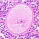 Illustration for article titled Older Ovaries, Not Older Eggs, May Reduce Fertility With Aging